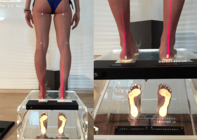 postura appoggio plantare